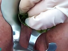Nettles Ass Fisting Anal Insertion Nettles with Speculum