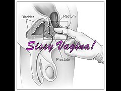 Sissy diagnosis perfect