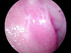 Camera deep inside of the wet pussy and captured the intense female orgasm!!