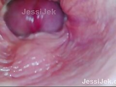 Dream babe got Twice Creampie Endoscope inside showed Extreme Fuck JessiJek