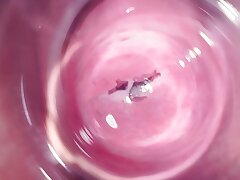 Inwards Mia's vagina, internal camera in teen pussy